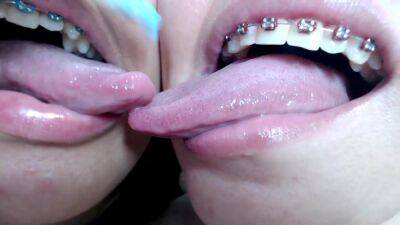 Deep tounge kissing between two brace lesbian on lesbiandaughter.com